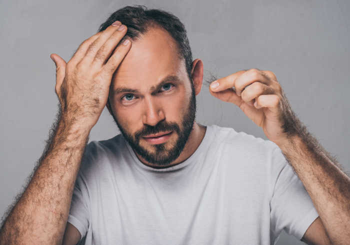 Bearded middle aged man holding fallen hair | does MK-677 Cause Hair Loss