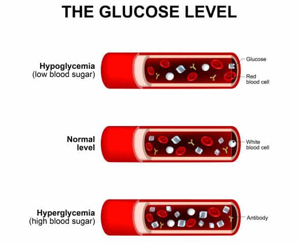 blood sugar level normal level hyperglycemia and hypoglycemia