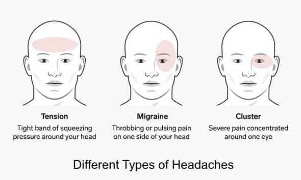 3 different kind of headaches : does MK-0677 cause headaches